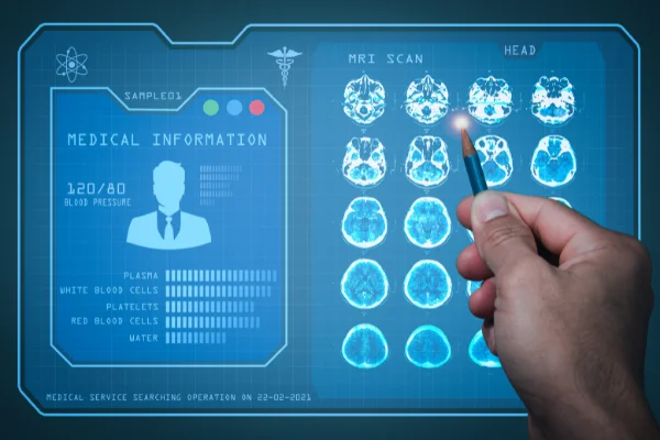 Cosa sono le tecniche di neuroimaging